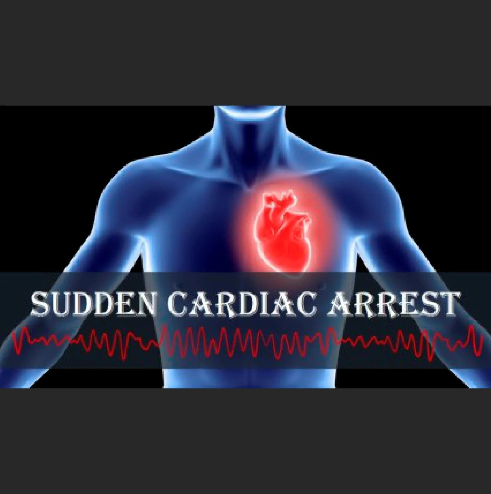Best Treatment for Sudden Cardiac Arrest at Gangasheel Hospital - Bareilly