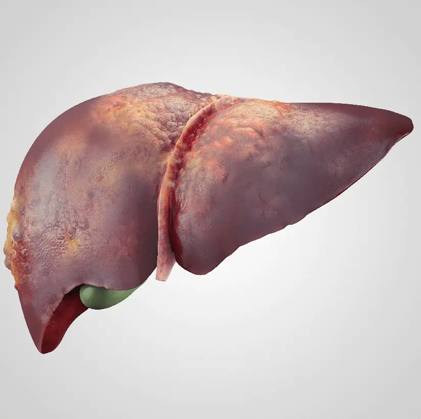 Treatment for Liver Cirrhosis and Gastro Instestinal Diseases in Bareilly - Gangasheel Hospital